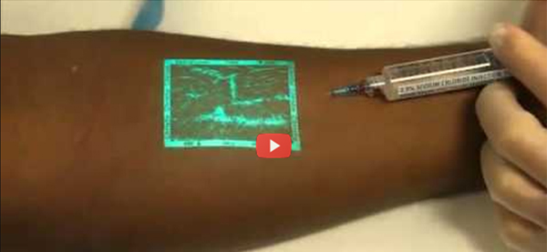 Finding Veins Made Simple With Veinviewer Video Health Tech Insider 4909